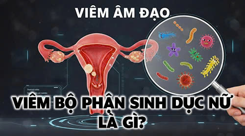 Viêm bộ phận sinh dục nữ là gì? Cẩm nang sức khỏe phụ khoa toàn diện
